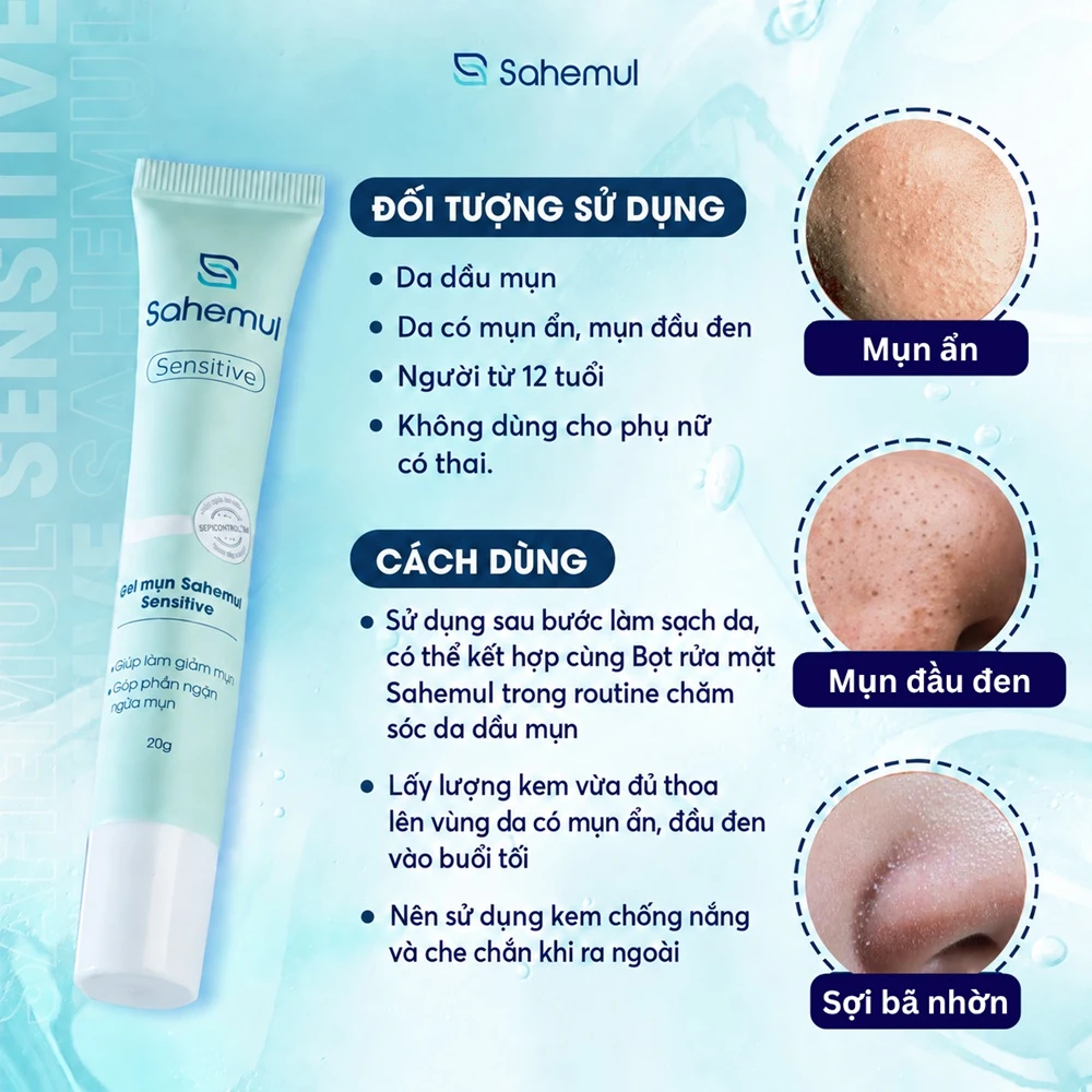 Mụn ẩn (1).webp